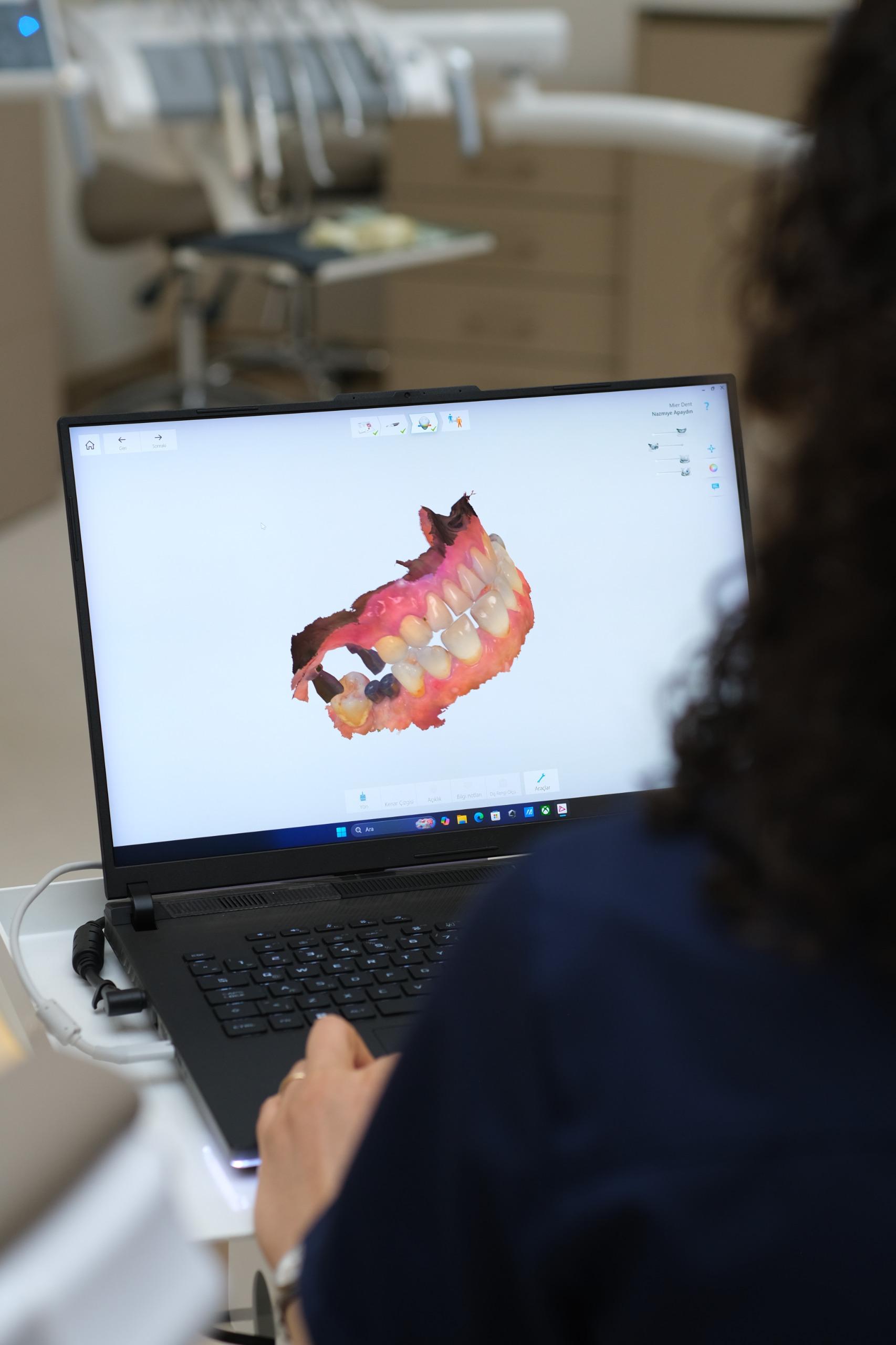 Mier Dental Clinic Ekibimiz 15