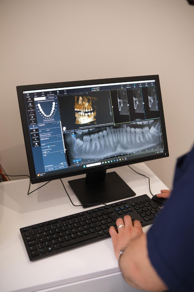 Mier Dental Clinic - Dijital Görüntüleme